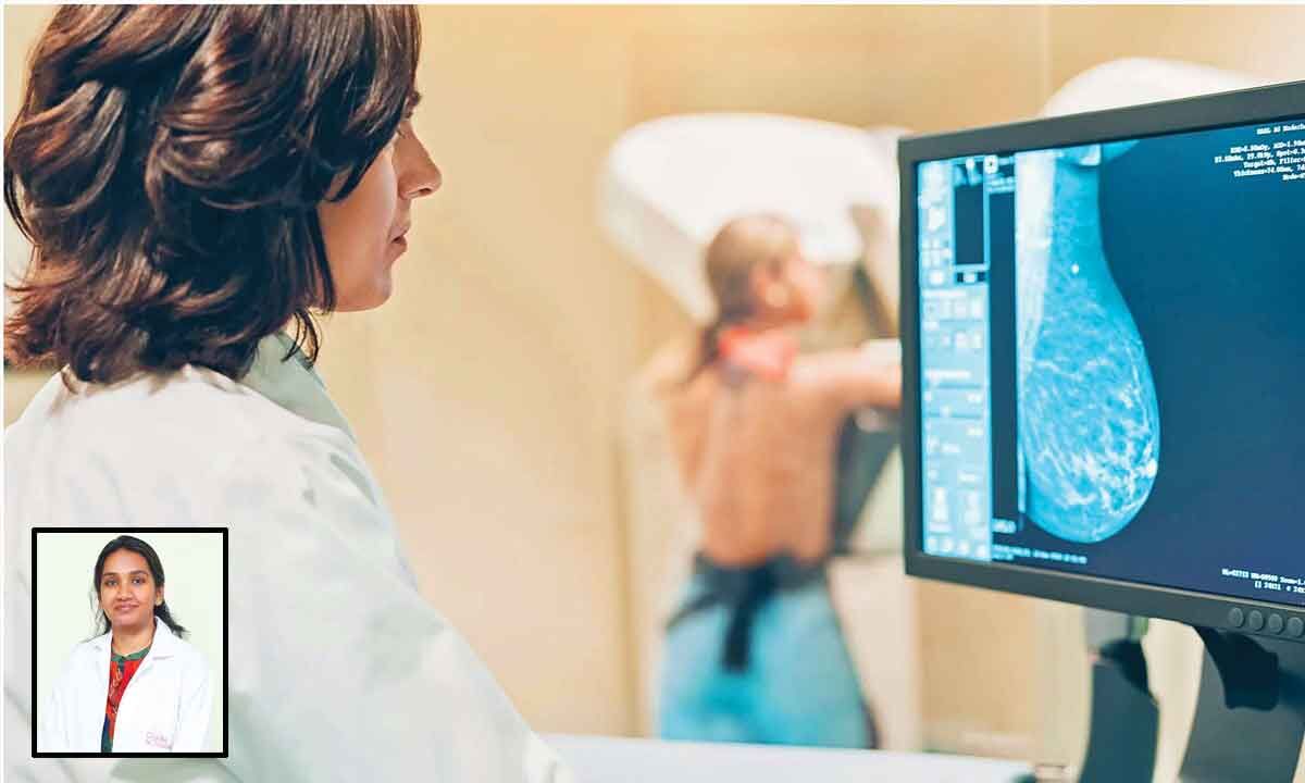 Revolutionising breast cancer detection:The role of AI